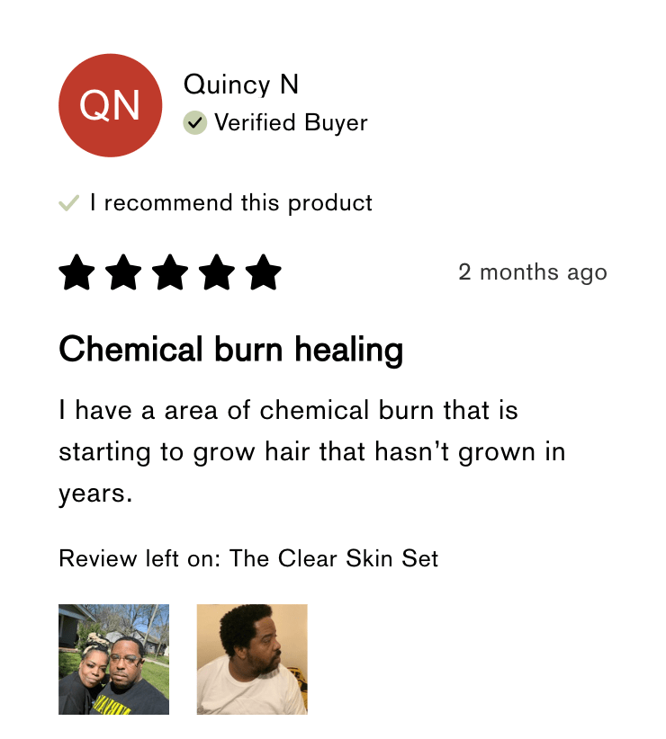 FLEX™ Pro Vibrating Face Brush